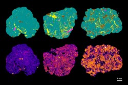 Oben: Zweidimensionale Anschnitte aus Röntgen-CT-Aufnahmen von Proben aus Parabraunerde-, Schwarzerde- und Gley-Böden, die sich in ihrem Feuchteregime unterscheiden (v.l.n.r.). Sie zeigen, wie verschieden Poren (gelb), organische Reste (violett), die Bodenmatrix (grün) und Steine (braun) verteilt sind. Unten: Die organische Bodensubstanz wurde mit Osmium markiert. Unterschiede im Kohlenstoffgehalt drücken sich in der mittleren Osmiumkonzentration von niedrig (blau) bis hoch (gelb) aus. Die Kohlenstoffgehalte sind in allen Böden kleinräumig variabel. Foto: UFZ Oben: Zweidimensionale Anschnitte aus Röntgen-CT-Aufnahmen von Proben aus Parabraunerde-, Schwarzerde- und Gley-Böden, die sich in ihrem Feuchteregime unterscheiden (v.l.n.r.). Sie zeigen, wie verschieden Poren (gelb), organische Reste (violett), die Bodenmatrix (grün) und Steine (braun) verteilt sind. Unten: Die organische Bodensubstanz wurde mit Osmium markiert. Unterschiede im Kohlenstoffgehalt drücken sich in der mittleren Osmiumkonzentration von niedrig (blau) bis hoch (gelb) aus. Die Kohlenstoffgehalte sind in allen Böden kleinräumig variabel. Foto: UFZ