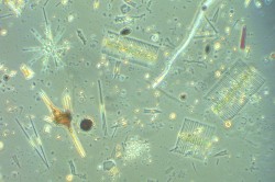 Blick durchs Mikroskop auf die vielfältige Mikroalgengemeinschaft eines Sees zu sehen sind verschiedene Kieselalgen (Diatomeen), Grünalgen und Panzergeißeltierchen (Dinoflagellaten). Foto: Maria Stockenreiter /LMU München Blick durchs Mikroskop auf die vielfältige Mikroalgengemeinschaft eines Sees zu sehen sind verschiedene Kieselalgen (Diatomeen), Grünalgen und Panzergeißeltierchen (Dinoflagellaten). Foto: Maria Stockenreiter /LMU München