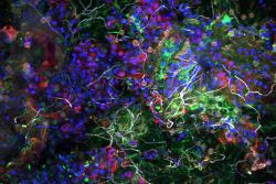 <p>Aufnahme der Plastisphäre eines Partikels aus dem Pazifischen Ozean mittels eines konfokalen Laser-Scanning-Mikroskops. Das Bild zeigt die biologischen Bestandteile (angefärbt), die in unmittelbarer räumlicher Nähe koexistieren: Bakterien (grün), Algen (blau), extrazelluläre Zuckermatrix (rot), Pilzhyphen (weiß).&nbsp;</p> Foto: Dr. Thomas Neu/UFZ