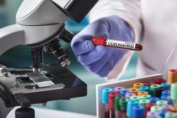 <p>PFAS not only appear to play a role in the development of several diseases of civilisation, they also influence the cellular immune response to coronavirus. </p>